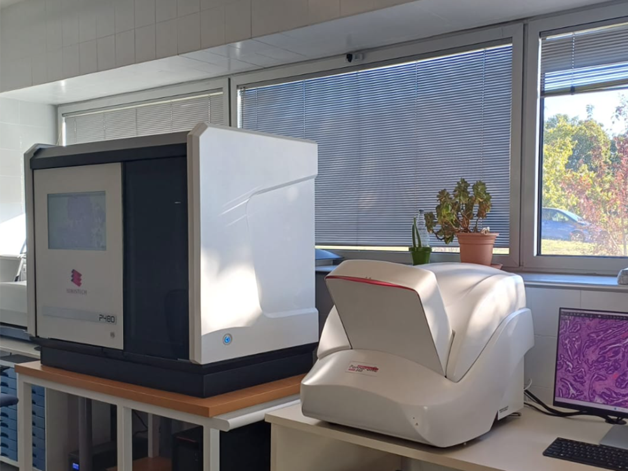 Els escàners de l'Hospital de Mataró